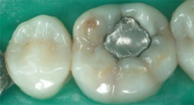 cure-dentali