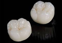 protesi-dentali