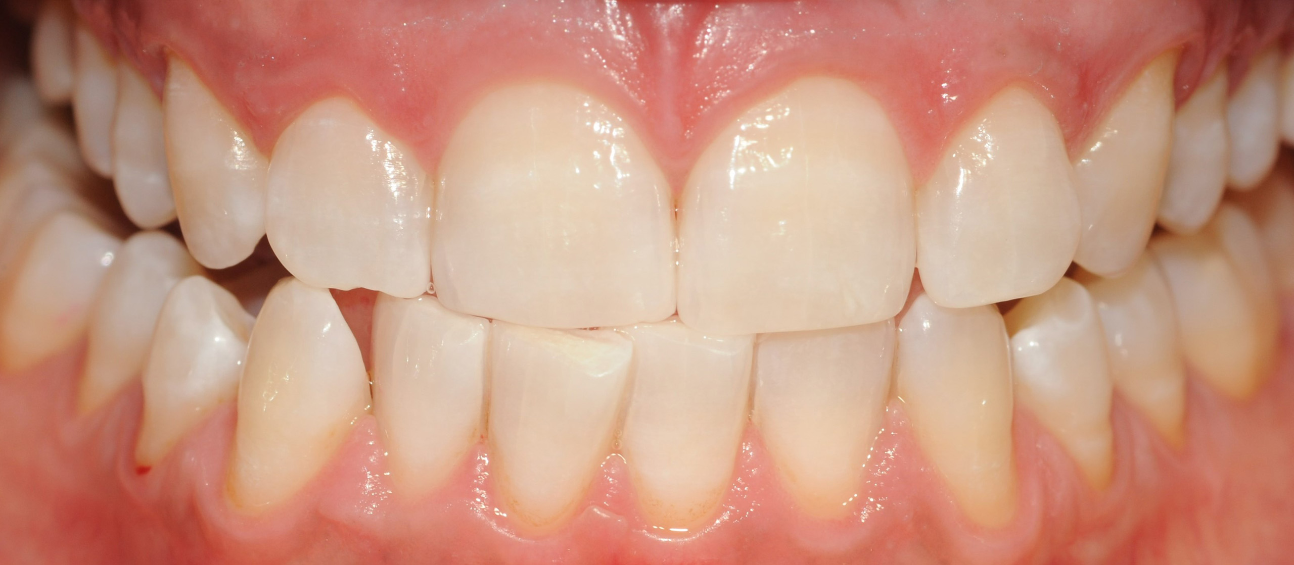 After Image