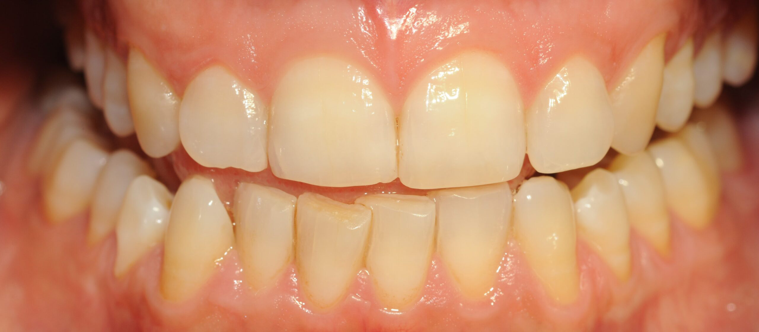 Before Image
